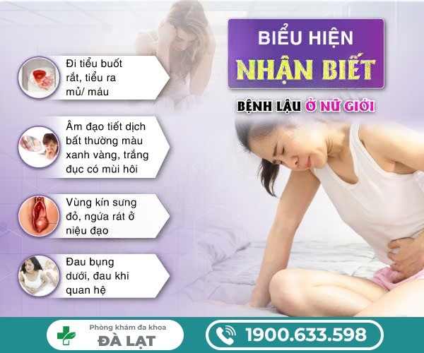 Hình ảnh minh họa